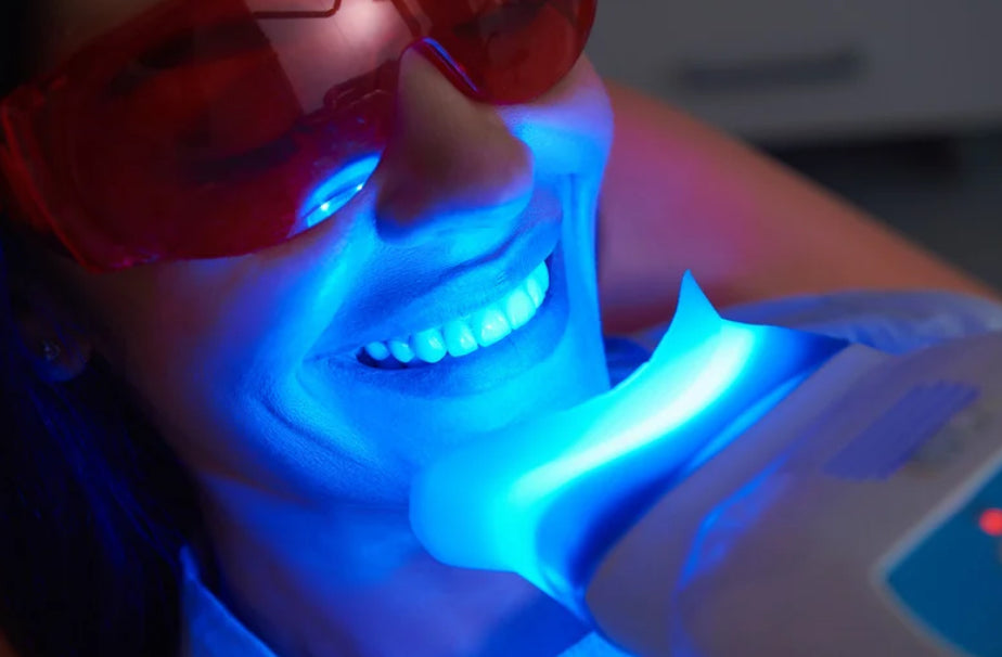 Teeth Whitening Special
